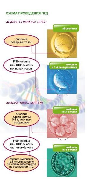 Проведение пренатальной диагностики нарушения развития ребенка в иркутской области thumbnail