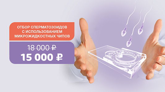 Отбор сперматозоидов на микрожидкостных чипах Fertile®: повысим шансы на успешное ЭКО